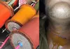 Bareilly News: बरेली में चाइनीज मांझे एक और छात्र की कटी गर्दन, पिछले कुछ दिनों में हो चुकीं कई घटनाएं 