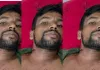 Bareilly News : बरेली में चोरों ने झोंकी फायर, युवक की गर्दन में फंसी गोली, फिर भी दिनभर घूमता रहा घायल 