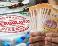 टीबी मरीजों का इंतजार अभी और लंबा... छह माह से नहीं मिल पा रहा पोषण भत्ता