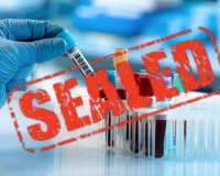  लैब में डॉक्टर न टेक्निशियन, मरीजों को करते थे गुमराह...  CMO ऑफिस के 500 मीटर में चलते मिले चार अवैध पैथोलॉजी सेंटर सील