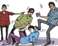 Lucknow News: एयरपोर्ट कर्मी पर जानलेवा हमला, आंख की रोशनी गई, कान का पर्दा भी फटा