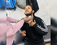 पीलीभीत: प्रतिबंधित चाइनीज मांझा बना मुसीबत, अब रालोद नेता घायल..अचानक गर्दन में आकर फंसा मांझा