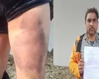 रायबरेली : परशदेपुर पुलिस पर बर्बरता का आरोप, पट्टे से युवक की जमकर पिटाई