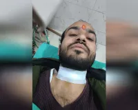 Bareilly : चाइनीज मांझे की चपेट में आकर अधिवक्ता घायल, शाहमतगंज पुल पर हुआ हादसा