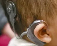 अब बच्चों को सुनने-बोलने की मिलेगी नई ताकत, SGPGI की पहल से कॉक्लियर इम्प्लांट होगा आसान