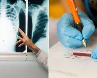 अब होगी अस्पतालों के किचन स्टाफ की टीबी जांच, बोले मुख्य सचिव- संक्रमण  रोकथाम के लिए जरूरी