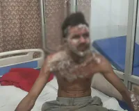 Bareilly : डिलीवरी बॉय ने थाने के गेट पर खुद को लगाई आग...वजह परेशान करने वाली है