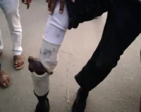 लखनऊ में छात्रों का खूनी संघर्ष: पुनर्वास विश्वविद्यालय और पॉलिटेक्निक के बीच पथराव, कई गाड़ियों में तोड़फोड़, आधा दर्जन से अधिक घायल