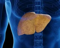 केजीएमयू में पार्टो से तकनीक से इलाज, लिवर सिरोसिस से मरीज को दिया नया जीवन, महिला के पेट में हो रहा था रक्तस्राव