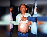 Uttrakhand: रेट्रो साइलेंसर से फोड़े पटाखे, विरोध किया तो गर्दन पर चलाया चाकू