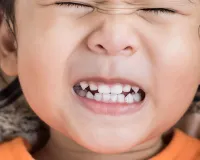 Bareilly : रात में दांत घिसने की आदत से बच्चों के मौखिक स्वास्थ्य पर बढ़ता है खतरा