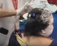 बहराइच : पुतला दहन के दौरान आग में खुद भी झुलस गईं पूर्व मंत्री अनुपमा जायसवाल, अस्पताल में भर्ती