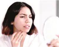 बिना केमिकल के पाएं सॉफ्ट लिप्स