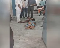 Bareilly:बगैर एंबुलेंस के ठेली पर मरीज, टैंपो में लाश के बाद अब झुलसे युवक की चीखों से सामने आया सिस्टम का सच