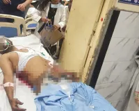 लखनऊ अग्निकांड : जान बचाने को दूसरी मंजिल की खिड़की से जयंत ने लगाई छलांग, कमर में घुस गई सरिया