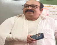 Barabanki News : गड्ढे के ऊपर था रेड कार्पेट, गिरने से टूटा एसीएमओ का हाथ 