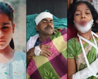 Rampur News : रोडवेज बस व ट्रैक्टर-ट्रॉली की टक्कर, किशोरी की मौत.. कईं बच्चों सहित 16 घायल