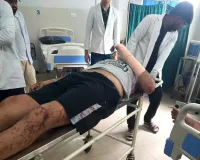  मोबाइल पर स्टेटस लगा असिस्टेंट प्रोफेसर ने काटी कलाई की नस 