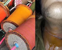 Bareilly News: बरेली में चाइनीज मांझे एक और छात्र की कटी गर्दन, पिछले कुछ दिनों में हो चुकीं कई घटनाएं 