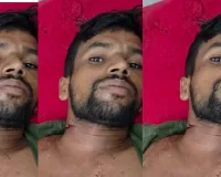 Bareilly News : बरेली में चोरों ने झोंकी फायर, युवक की गर्दन में फंसी गोली, फिर भी दिनभर घूमता रहा घायल 
