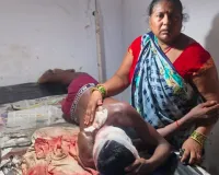 Lakhimpur Kheri : बेटे पर हमला देख भिड़ गये पिता, युवक को छोड़कर भागा तेंदुआ 