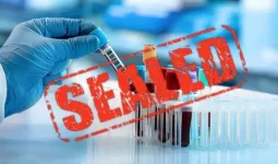 Moradabaad : छापेमारी में बिना पंजीकरण मिली पैथोलॉजी लैब सील