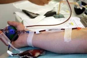 अमेरिका में गंभीर कोरोना मरीजों का रक्त पतला कर उपचार करने पर रोक