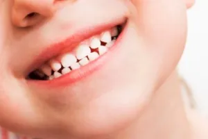 बरेली: दूध के दांत भी होते हैं महत्वपूर्ण, जानें बाल रोग विशेषज्ञ से