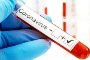 बरेली: एंटीजन से जांच रिपोर्ट निगेटिव, सीटी स्कैन में निकल रही पॉजीटिव