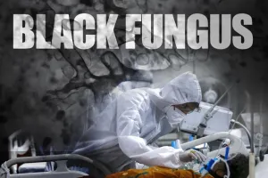 इंजेक्शन का रिएक्शन: एम्फोटेरिसिन-बी लगने के बाद ठंड से कांपने लगे ब्लैक फंगज के मरीज