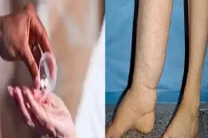 बरेली: जिले में 12 लाख लोगों ने खाई फाइलेरिया की दवा