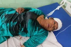 बरेली: ग्रीन पार्क में किन्नरों के दो गुटों में मारपीट, बांका लगने से एक घायल