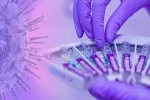 बरेली: एक बार फिर सैंपलिंग को तैनात की एमएमयू