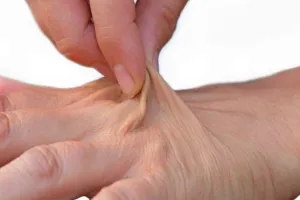 शरीर में दिख रहे हैं ये लक्षण तो आप हो चुके हैं Dehydration का शिकार