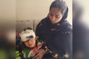 पीलीभीत: बुजुर्ग की जान लेने के बाद अब आवारा कुत्तों ने चार साल की बच्ची पर बोला हमला