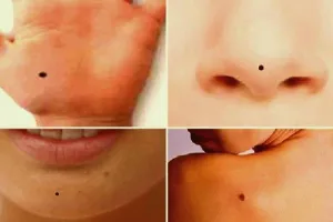 शरीर पर बने तिल से जानें अपना भाग्य, कमाएंगे या गंवाएंगे