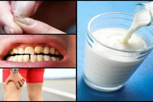 Calcium Deficiency : बच्चों में इन कारणों से हो सकती है कैल्शियम की कमी, लक्षणों को न करें नजरअंदाज…