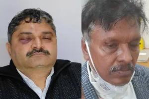 लखनऊ: बीबीएयू में शिक्षक और उप कुलसचिव के बीच हुई मारपीट, केस दर्ज