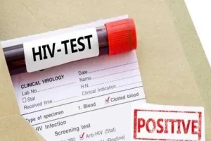 काशीपुर: पिछले पांच वर्षों में 52 एचआईवी संक्रमित मरीज मिले