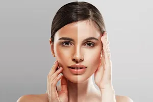 गर्मी में इन घरेलू नुस्खों से करें टैनिंग को दूर, मिलेगी खूबसूरत त्वचा