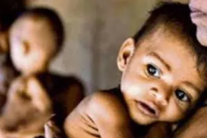 बरेली: गाय के दूध से कुपोषित बच्चों की सेहत का रखा जाएगा ध्यान