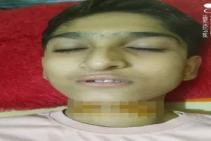 अमरोहा : चाइनीज मांझे से कटी छात्र की गर्दन, घायल