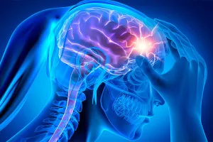 गर्मी में माइग्रेन की समस्या क्यों बढ़ जाती है, जानें एक्सपर्ट से बचाव के तरीके