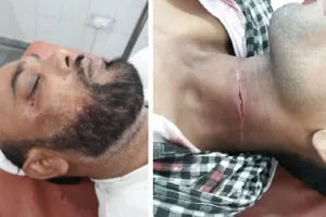 रामपुर : चाइनीज मांझे की चपेट में आकर दो लोग घायल, अस्पताल में भर्ती