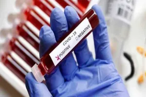 बरेली: कोरोना संक्रमण की बढ़ रही रफ्तार, घट रही सैंपलिंग