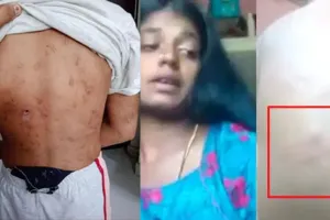 गौतम बुद्ध नगर: मां ने कि क्रूरता की हदें पार, बच्ची की बेरहमी से की पिटाई