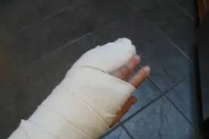 मेरठ : बाइक फिसलने से घायल हुआ युवक, फर्श पर लिटाकर अस्पताल में हुआ इलाज