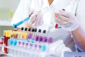 वाराणसी : रीजेंट खत्म होने से नहीं हो पा रही कई एहम जांच