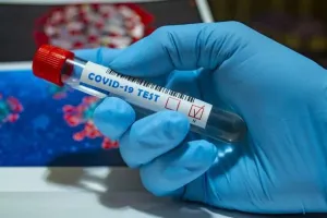 बरेली: कोरोना को लेकर स्वास्थ्य विभाग अलर्ट, जिले में हर रोज होंगी पांच हजार जांचें