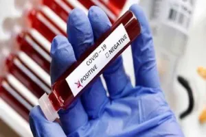 बरेली: बढ़ रहा कोरोना संक्रमण, घट रही सैंपलिंग, CMO को चेतावनी